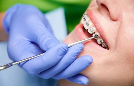 טיפולי יישור שיניים לכל הגילאים